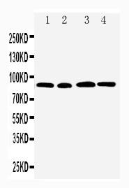 HMMR / CD168 / RHAMM Antibody - WB of HMMR / CD168 / RHAMM antibody. All lanes: Anti-HMMR at 0.5ug/ml. Lane 1: MM231 Whole Cell Lysate at 40ug. Lane 2: MM453 Whole Cell Lysate at 40ug. Lane 3: HELA Whole Cell Lysate at 40ug. Lane 4: A549 Whole Cell Lysate at 40ug. Predicted bind size: 84KD. Observed bind size: 90KD.