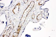 HMMR / CD168 / RHAMM Antibody - HMMR / CD168 / RHAMM antibody. IHC(P): Human Placenta Tissue.