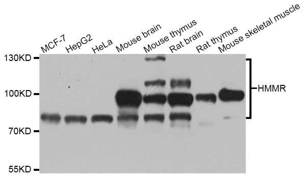 HMMR / CD168 / RHAMM Antibody - Western blot analysis of extracts of various cell lines, using CD168 antibody at 1:1000 dilution. The secondary antibody used was an HRP Goat Anti-Rabbit IgG (H+L) at 1:10000 dilution. Lysates were loaded 25ug per lane and 3% nonfat dry milk in TBST was used for blocking.
