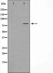 HMMR / CD168 / RHAMM Antibody - Western blot analysis of extracts of HepG2 cells using HMMR antibody. The lane on the left is treated with the antigen-specific peptide.