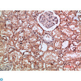 HMMR / CD168 / RHAMM Antibody - Immunohistochemical analysis of paraffin-embedded human-kidney, antibody was diluted at 1:200.