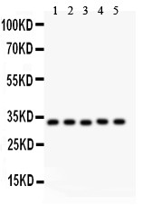 HMOX1 / HO-1 Antibody - HMOX1 antibody Western blot. All lanes: Anti HMOX1 at 0.5 ug/ml. Lane 1: Human Placenta Tissue Lysate at 50 ug. Lane 2: Rat Spleen Tissue Lysate at 50 ug. Lane 3: A549 Whole Cell Lysate at 40 ug. Lane 4: PANC Whole Cell Lysate at 40 ug. Lane 5: HELA Whole Cell Lysate at 40 ug. Predicted band size: 33 kD. Observed band size: 33 kD.