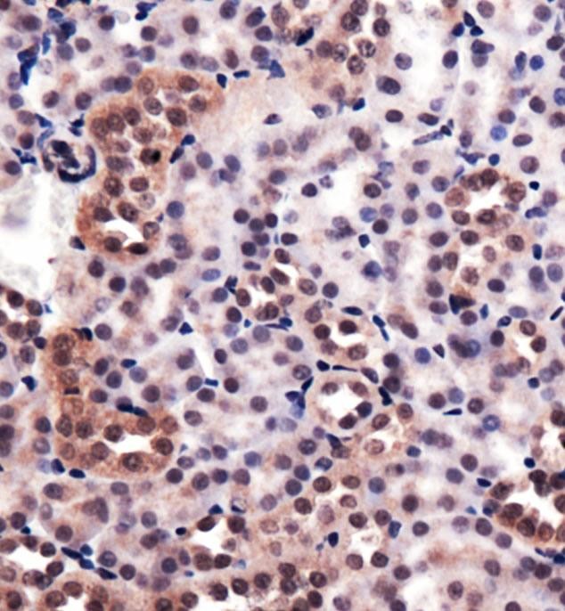 HMOX1 / HO-1 Antibody - Immunohistochemistry: Heme Oxygenase 1 Antibody - Analysis of Heme Oxygenase 1 in mouse kidney using DAB with hematoxylin counterstain.  This image was taken for the unconjugated form of this product. Other forms have not been tested.