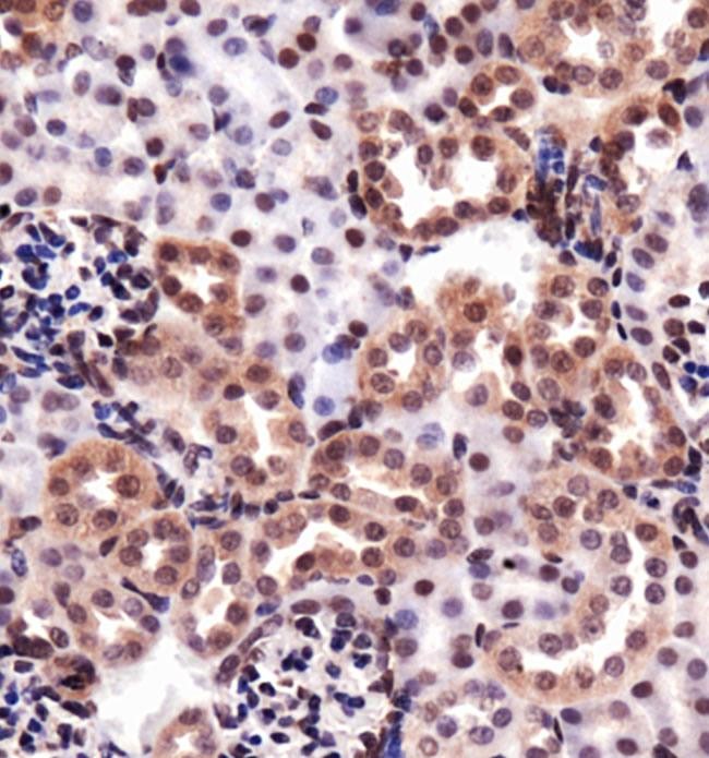 HMOX1 / HO-1 Antibody - Immunohistochemistry: Heme Oxygenase 1 Antibody - Analysis of heme oxygenase mouse kidney using DAB with hematoxylin counterstain.  This image was taken for the unconjugated form of this product. Other forms have not been tested.
