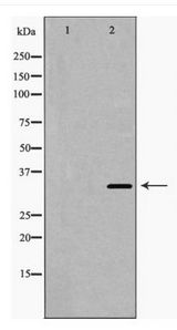 HMOX1 / HO-1 Antibody - Western blot of HO-1 expression in fetal liver lysate
