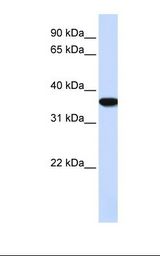 HMOX1 / HO-1 Antibody - HepG2 cell lysate. Antibody concentration: 1.0 ug/ml. Gel concentration: 12%.  This image was taken for the unconjugated form of this product. Other forms have not been tested.
