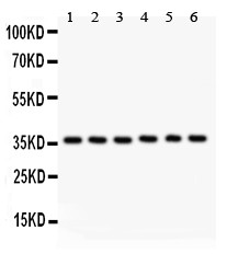 HMOX2 / Heme Oxygenase 2 Antibody - HMOX2 antibody Western blot. All lanes: Anti HMOX2 at 0.5 ug/ml. Lane 1: Rat Kidney Tissue Lysate at 50 ug. Lane 2: A549 Whole Cell Lysate at 40 ug. Lane 3: COLO320 Whole Cell Lysate at 40 ug. Lane 4: MM231 Whole Cell Lysate at 40 ug. Lane 5: HELA Whole Cell Lysate at 40 ug. Lane 6: SKOV Whole Cell Lysate at 40 ug. Predicted band size: 36 kD. Observed band size: 36 kD.