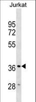HMOX2 / Heme Oxygenase 2 Antibody - HMOX2 Antibody western blot of Jurkat cell line lysates (35 ug/lane). The HMOX2 antibody detected the HMOX2 protein (arrow).