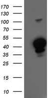HMOX2 / Heme Oxygenase 2 Antibody - HEK293T cells were transfected with the pCMV6-ENTRY control (Left lane) or pCMV6-ENTRY HMOX2 (Right lane) cDNA for 48 hrs and lysed. Equivalent amounts of cell lysates (5 ug per lane) were separated by SDS-PAGE and immunoblotted with anti-HMOX2.