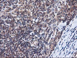 HMOX2 / Heme Oxygenase 2 Antibody - IHC of paraffin-embedded Human lymphoma tissue using anti-HMOX2 mouse monoclonal antibody.