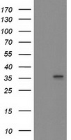 HMOX2 / Heme Oxygenase 2 Antibody - HEK293T cells were transfected with the pCMV6-ENTRY control (Left lane) or pCMV6-ENTRY HMOX2 (Right lane) cDNA for 48 hrs and lysed. Equivalent amounts of cell lysates (5 ug per lane) were separated by SDS-PAGE and immunoblotted with anti-HMOX2.