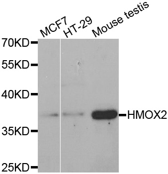 HMOX2 / Heme Oxygenase 2 Antibody - Western blot analysis of extracts of various cell lines.