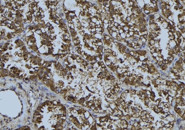 HMOX2 / Heme Oxygenase 2 Antibody - 1:100 staining mouse testis tissue by IHC-P. The sample was formaldehyde fixed and a heat mediated antigen retrieval step in citrate buffer was performed. The sample was then blocked and incubated with the antibody for 1.5 hours at 22°C. An HRP conjugated goat anti-rabbit antibody was used as the secondary.