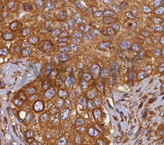HMOX2 / Heme Oxygenase 2 Antibody - 1/100 staining human breast  tissue by IHC-P. The sample was formaldehyde fixed and a heat mediated antigen retrieval step in citrate buffer was performed. The sample was then blocked and incubated with the antibody for 1.5 hours at 22°C. An HRP conjugated goat anti-rabbit antibody was used as the secondary antibody.