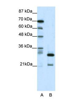 HMOX2 / Heme Oxygenase 2 Antibody - HMOX2 / Heme Oxygenase 2 antibody Western blot of Jurkat Cell lysate. Antibody concentration 1 ug/ml. This image was taken for the unconjugated form of this product. Other forms have not been tested.