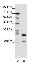 HMOX2 / Heme Oxygenase 2 Antibody - A: Marker, B: Jurkat Cell Lysate.  This image was taken for the unconjugated form of this product. Other forms have not been tested.