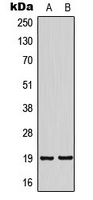 HMP19 Antibody - Western blot analysis of NSG2 expression in SHSY5Y (A); HeLa (B) whole cell lysates.