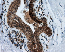 HMRF1L / MTRF1L Antibody - IHC of paraffin-embedded breast tissue using anti-MTRF1L mouse monoclonal antibody. (Dilution 1:50).