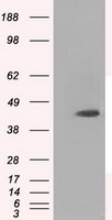 HMRF1L / MTRF1L Antibody - HEK293T cells were transfected with the pCMV6-ENTRY control (Left lane) or pCMV6-ENTRY MTRF1L (Right lane) cDNA for 48 hrs and lysed. Equivalent amounts of cell lysates (5 ug per lane) were separated by SDS-PAGE and immunoblotted with anti-MTRF1L.
