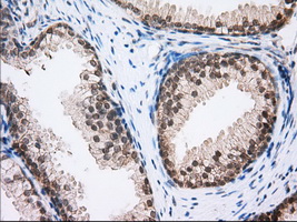 HMRF1L / MTRF1L Antibody - Immunohistochemical staining of paraffin-embedded Human prostate tissue using anti-MTRF1L mouse monoclonal antibody. (Dilution 1:50).