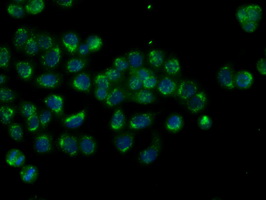 HMRF1L / MTRF1L Antibody - Immunofluorescent staining of HT29 cells using anti-MTRF1L mouse monoclonal antibody.