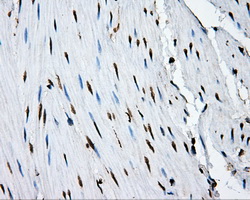 HMRF1L / MTRF1L Antibody - Immunohistochemical staining of paraffin-embedded colon tissue using anti-MTRF1L mouse monoclonal antibody. (Dilution 1:50).