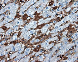 HMRF1L / MTRF1L Antibody - Immunohistochemical staining of paraffin-embedded liver tissue using anti-MTRF1L mouse monoclonal antibody. (Dilution 1:50).