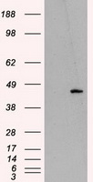 HMRF1L / MTRF1L Antibody - HEK293T cells were transfected with the pCMV6-ENTRY control (Left lane) or pCMV6-ENTRY MTRF1L (Right lane) cDNA for 48 hrs and lysed. Equivalent amounts of cell lysates (5 ug per lane) were separated by SDS-PAGE and immunoblotted with anti-MTRF1L.