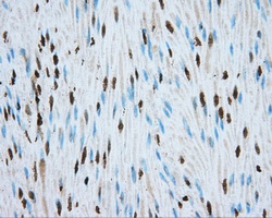HMRF1L / MTRF1L Antibody - Immunohistochemical staining of paraffin-embedded Human colon tissue using anti-MTRF1L mouse monoclonal antibody. (Dilution 1:50).