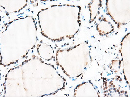 HMRF1L / MTRF1L Antibody - Immunohistochemical staining of paraffin-embedded Human thyroid tissue using anti-MTRF1L mouse monoclonal antibody. (Dilution 1:50).