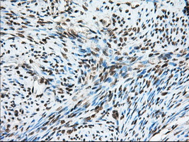 HMRF1L / MTRF1L Antibody - Immunohistochemical staining of paraffin-embedded Human endometrium tissue using anti-MTRF1L mouse monoclonal antibody. (Dilution 1:50).