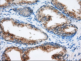 HMRF1L / MTRF1L Antibody - IHC of paraffin-embedded prostate tissue using anti-MTRF1L mouse monoclonal antibody. (Dilution 1:50).
