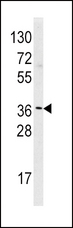 HMT / HNMT Antibody - Western blot of HNMT Antibody in HeLa cell line lysates (35 ug/lane). HNMT(arrow) was detected using the purified polyclonal antibody.