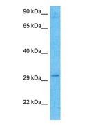 HMT / HNMT Antibody - Western blot of HNMT Antibody with human 786-0 Whole Cell lysate.  This image was taken for the unconjugated form of this product. Other forms have not been tested.