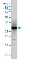 HMT / HNMT Antibody - HNMT monoclonal antibody (M03), clone 3G12 Western Blot analysis of HNMT expression in HeLa.