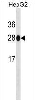 HMT / HNMT Antibody - HNMT Antibody western blot of HepG2 cell line lysates (35 ug/lane). The HNMT antibody detected the HNMT protein (arrow).