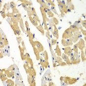 HMT / HNMT Antibody - Immunohistochemistry of paraffin-embedded mouse heart using HNMT antibody at dilution of 1:100 (40x lens).