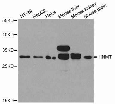 HMT / HNMT Antibody - Western blot analysis of extracts of various cell lines, using HNMT antibody at 1:1000 dilution. The secondary antibody used was an HRP Goat Anti-Rabbit IgG (H+L) at 1:10000 dilution. Lysates were loaded 25ug per lane and 3% nonfat dry milk in TBST was used for blocking. An ECL Kit was used for detection and the exposure time was 90s.