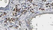 HMT / HNMT Antibody - 1:100 staining human prostate tissue by IHC-P. The sample was formaldehyde fixed and a heat mediated antigen retrieval step in citrate buffer was performed. The sample was then blocked and incubated with the antibody for 1.5 hours at 22°C. An HRP conjugated goat anti-rabbit antibody was used as the secondary.