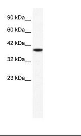HMX1 Antibody - Daudi Cell Lysate.  This image was taken for the unconjugated form of this product. Other forms have not been tested.
