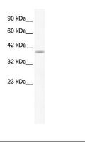 HMX1 Antibody - Daudi Cell Lysate.  This image was taken for the unconjugated form of this product. Other forms have not been tested.