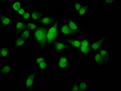HMX2 Antibody - Immunofluorescence staining of Hela cells diluted at 1:100, counter-stained with DAPI. The cells were fixed in 4% formaldehyde, permeabilized using 0.2% Triton X-100 and blocked in 10% normal Goat Serum. The cells were then incubated with the antibody overnight at 4°C.The Secondary antibody was Alexa Fluor 488-congugated AffiniPure Goat Anti-Rabbit IgG (H+L).