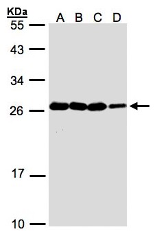 HN1 / ARM2 Antibody - Sample(30 ug whole cell lysate). A: A431. B: H1299. C: HeLa S3. D: Hep G2. 12% SDS PAGE. HN1 antibody diluted at 1:1000.