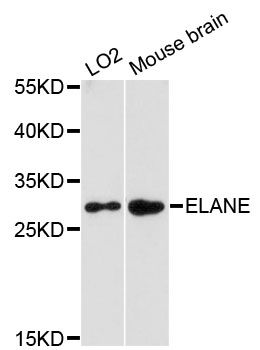 HNE / Neutrophil Elastase Antibody - Western blot analysis of extracts of various cell lines, using ELANE antibody at 1:3000 dilution. The secondary antibody used was an HRP Goat Anti-Rabbit IgG (H+L) at 1:10000 dilution. Lysates were loaded 25ug per lane and 3% nonfat dry milk in TBST was used for blocking. An ECL Kit was used for detection and the exposure time was 90s.