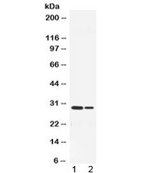 HNE / Neutrophil Elastase Antibody - Western blot testing of 1) mouse bone and 2) mouse spleen lysate with Neutrophil Elastase antibody at 0.5ug/ml. Expected molecular weight: 29-35 kDa.