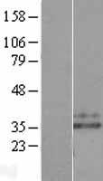 HNE / Neutrophil Elastase Protein - Western validation with an anti-DDK antibody * L: Control HEK293 lysate R: Over-expression lysate