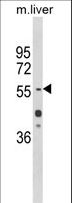 HNF1A / HNF1 Antibody - Western blot of HNF1A Antibody in mouse liver tissue lysates (35 ug/lane). HNF1A (arrow) was detected using the purified antibody.