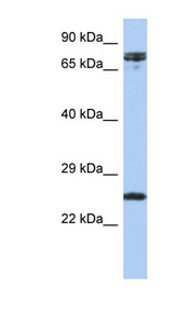 HNF1A / HNF1 Antibody - HNF1A / TCF1 antibody Western blot of OVCAR-3 cell lysate. This image was taken for the unconjugated form of this product. Other forms have not been tested.