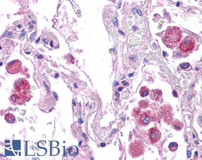 HNF1A / HNF1 Antibody - Anti-HNF1A / TCF1 antibody IHC of human lung. Immunohistochemistry of formalin-fixed, paraffin-embedded tissue after heat-induced antigen retrieval. Antibody concentration 5 ug/ml.  This image was taken for the unconjugated form of this product. Other forms have not been tested.