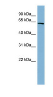 HNF1A / HNF1 Antibody - HNF1A / TCF1 antibody Western blot of Fetal Kidney lysate. This image was taken for the unconjugated form of this product. Other forms have not been tested.